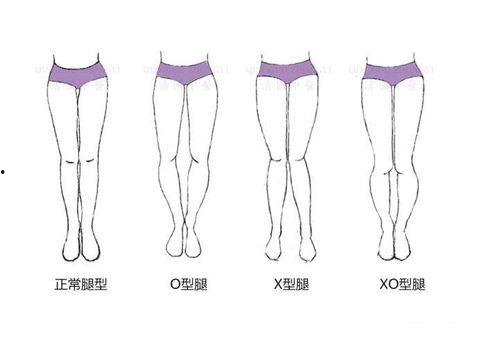 成人o型腿视频,从成因到康复，视频揭秘矫正过程