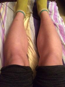 成人o型腿视频,从成因到康复,视频揭秘矫正过程